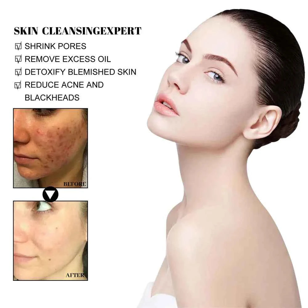 Blackhead Remove Solid Mud Film Refreshing Skin Cleaning Face Mask