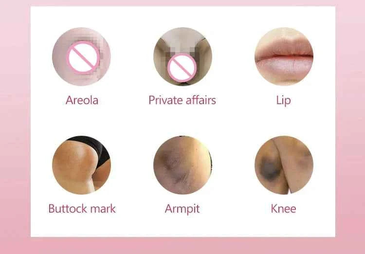 Collagen Whitening Cream Intimate Area Dark Skin Removeal Sensitive Areas Underarm Inner Thigh Lightening Body Cream Skin Care