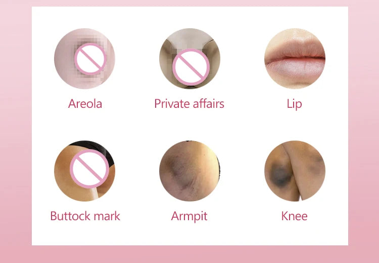 Collagen Private Body Whitening Cream Bikini Cream Underarm Armpit Buttock Knees Private Area Whitening Brighten Skin Body Care - Shello's Creative Boutique