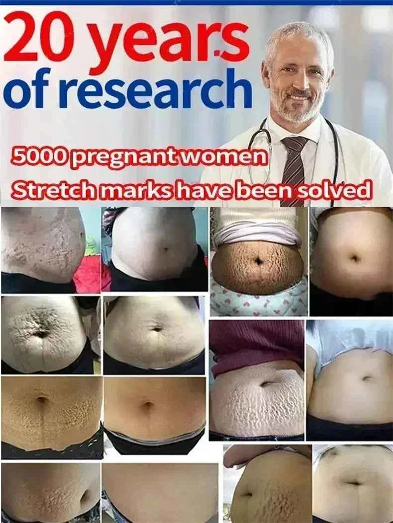 Maternity Stretch Mark Permanent Removal cream Brighten Anti-Winkle Smooth Repair Firming Restore Skin Elasticity Body Skin Care