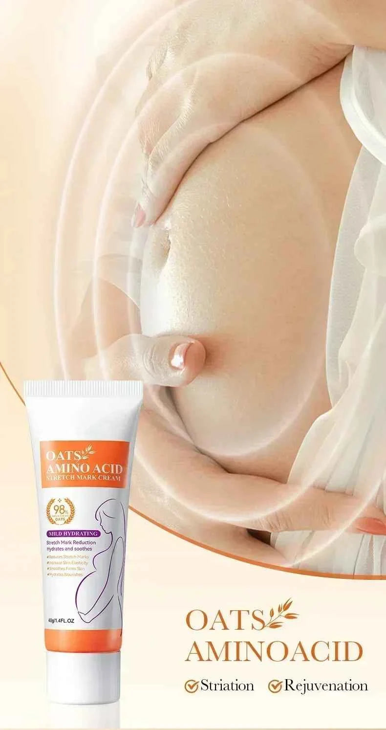 Maternity Stretch Mark Permanent Removal cream Brighten Anti-Winkle Smooth Repair Firming Restore Skin Elasticity Body Skin Care
