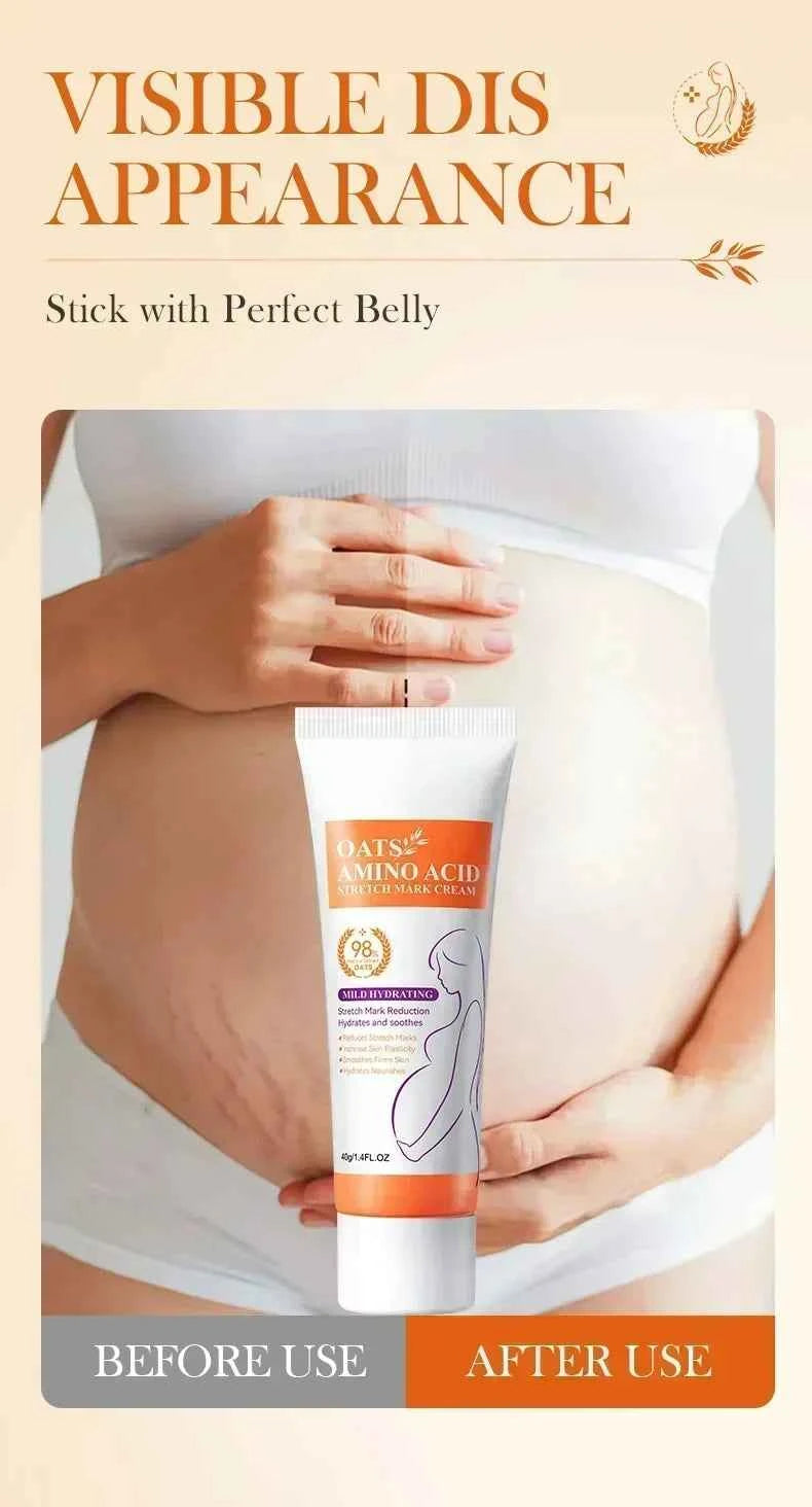 Maternity Stretch Mark Permanent Removal cream Brighten Anti-Winkle Smooth Repair Firming Restore Skin Elasticity Body Skin Care