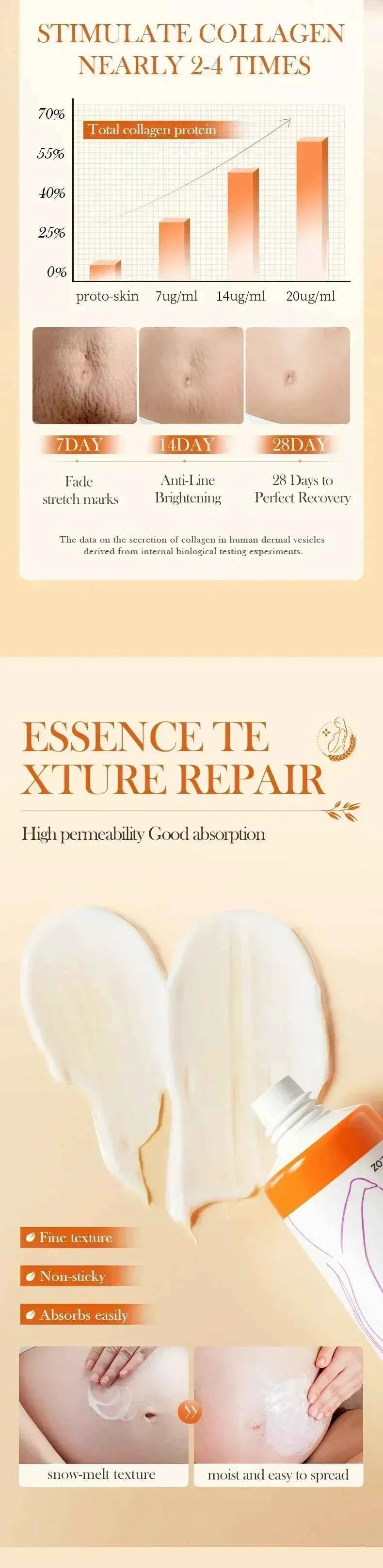 Maternity Stretch Mark Permanent Removal cream Brighten Anti-Winkle Smooth Repair Firming Restore Skin Elasticity Body Skin Care