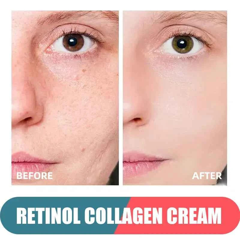 Retinol Cream for Face with Hyaluronic Acid, Day-Night Anti-Aging Moisturizer Collagen Cream for Face Reduces Wrinkles, Dryness