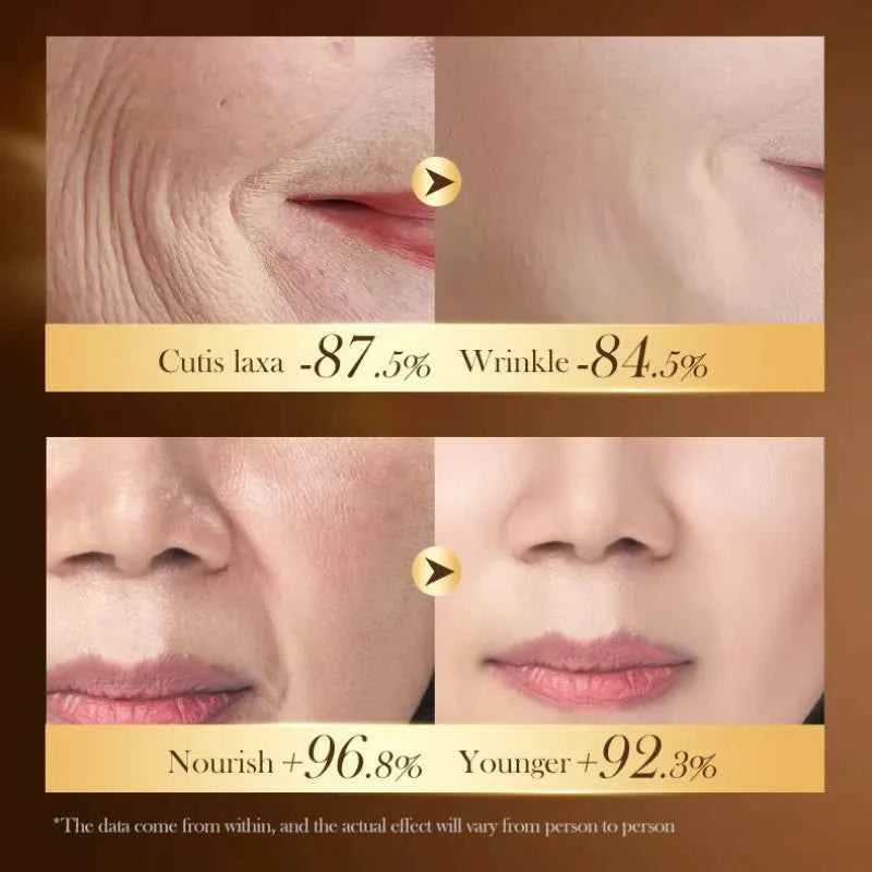 SADOER Caviar DNA Sodium Collagen Frming Cream for Moisturizing Nourish Anti-age Skin Care 30g