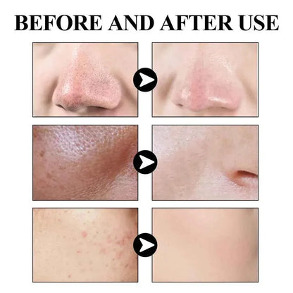 Blackhead Removal Face Mask - Solid Mud for Refreshing Skin Cleanliness - Shello's Creative Boutique