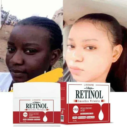 eelhoe 3-in-1 Whitening & Repair Cream – Retinol + Collagen + Hyaluronic Acid – 50ml - Shello's Creative Boutique