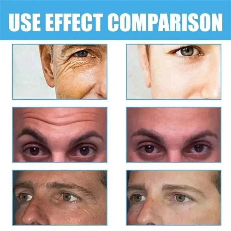 Retinol Anti-wrinkle Cream For Men Collagen Anti-Aging Removal Face & Neck Wrinkle Efficient Moisturize Firming Korean Skin Care