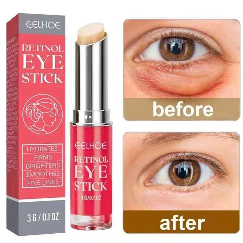 EElhoe RadiantLift Retinol Eye Cream – 3g - Shello's Creative Boutique