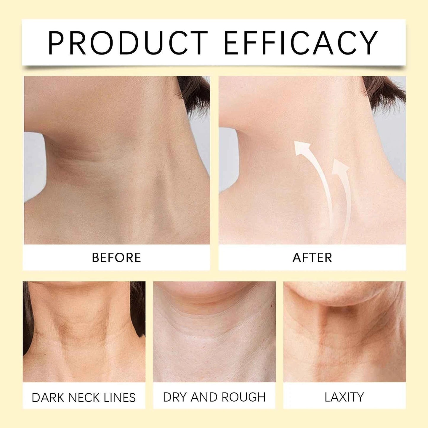 Bee-Venom Neck Care Stick Contains Collagen  Lift & Tighten Skin Lighten Neck Lines Double Chin Moisturizing Beauty Neck Cream