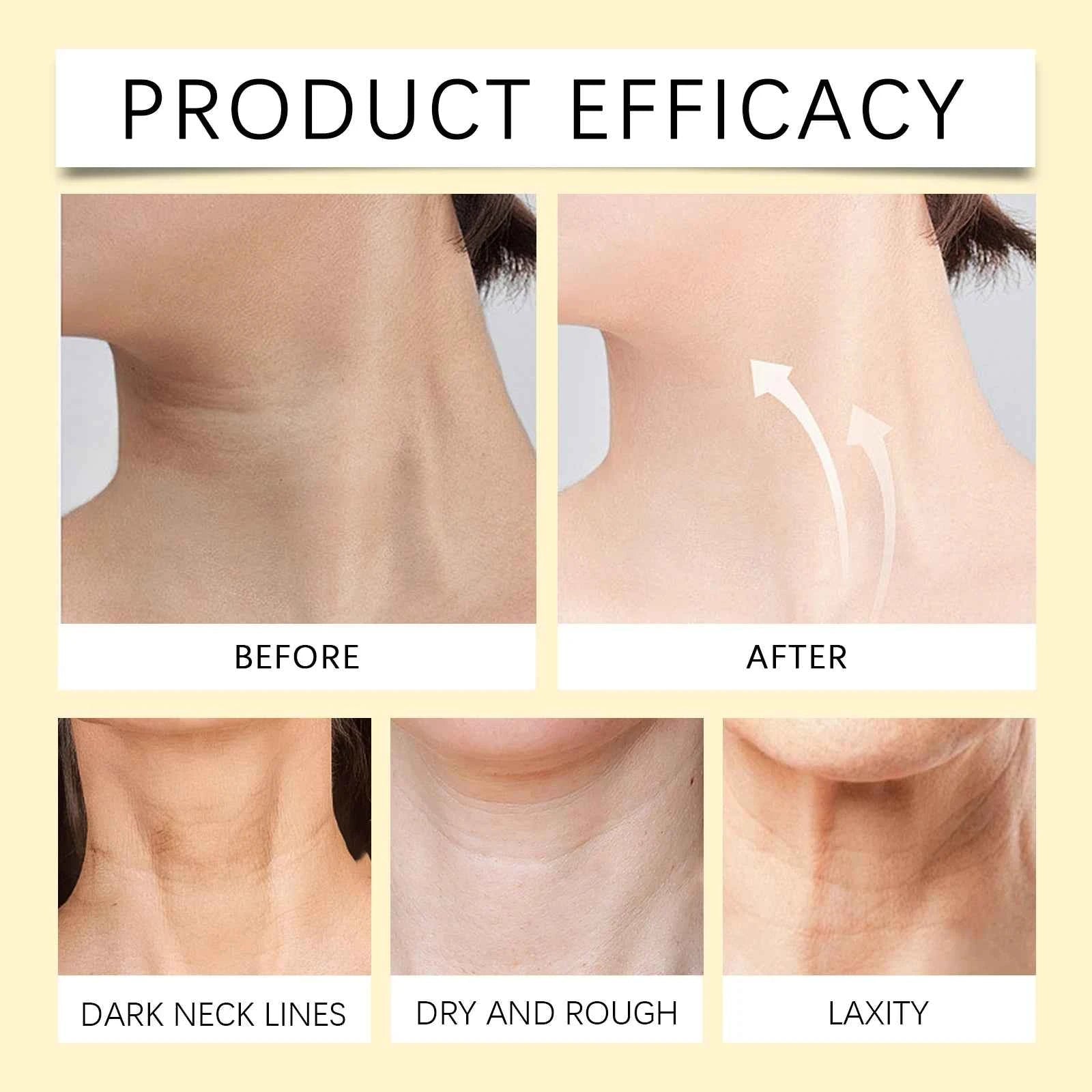 Bee-Venom Neck Care Stick Contains Collagen  Lift & Tighten Skin Lighten Neck Lines Double Chin Moisturizing Beauty Neck Cream