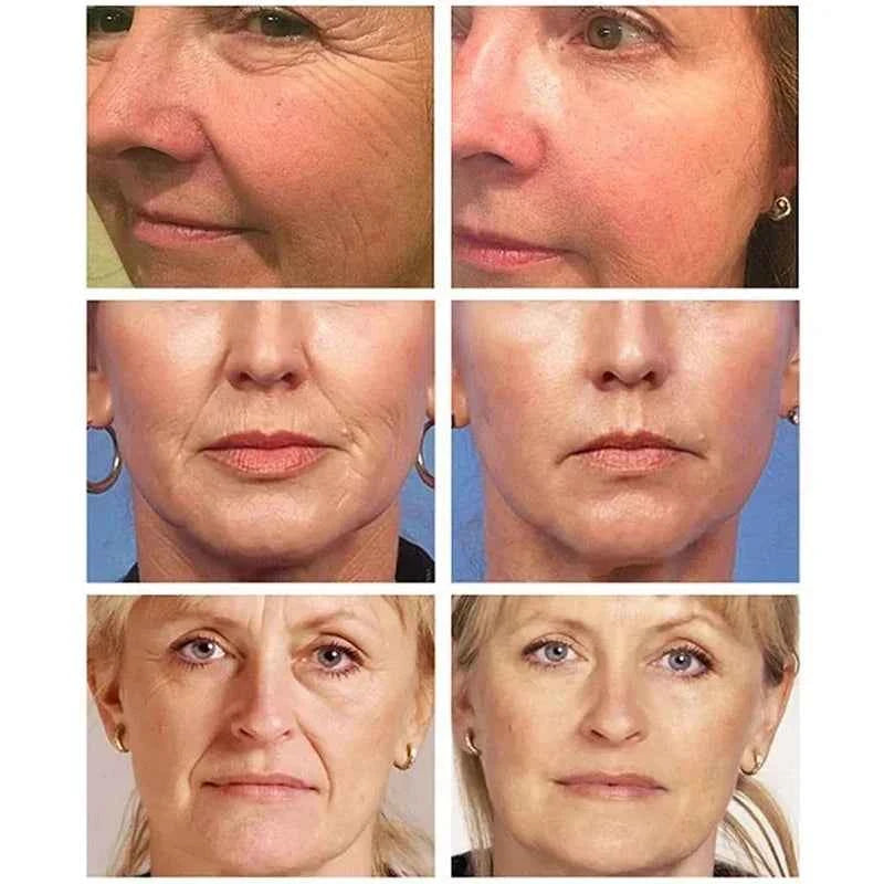 Retinol Anti-wrinkle Cream For Men Collagen Anti-Aging Removal Face & Neck Wrinkle Efficient Moisturize Firming Korean Skin Care