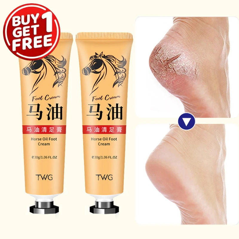 Ma You Qing Foot Cream, Moisturizing Foot Cream, Suitable for Dry Skin, Suitable for Hand and Foot Care for Dry Hands and Feet - Shello's Creative Boutique