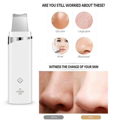 K-SKIN KD-8023Ultrasonic Blackhead Acne Removal Pore Cleaner Facial Skin Care Scrubber Exfoliating Pore Cleaner, KD-8023 - Shello's Creative Boutique