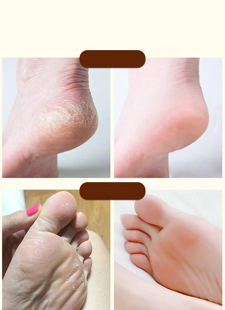 Ma You Qing Foot Cream, Moisturizing Foot Cream, Suitable for Dry Skin, Suitable for Hand and Foot Care for Dry Hands and Feet - Shello's Creative Boutique