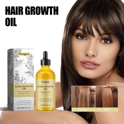 Rosemary Dense Hair Essential Oil - Hair Loss Prevention & Regrowth 60/120ml - Shello's Creative Boutique